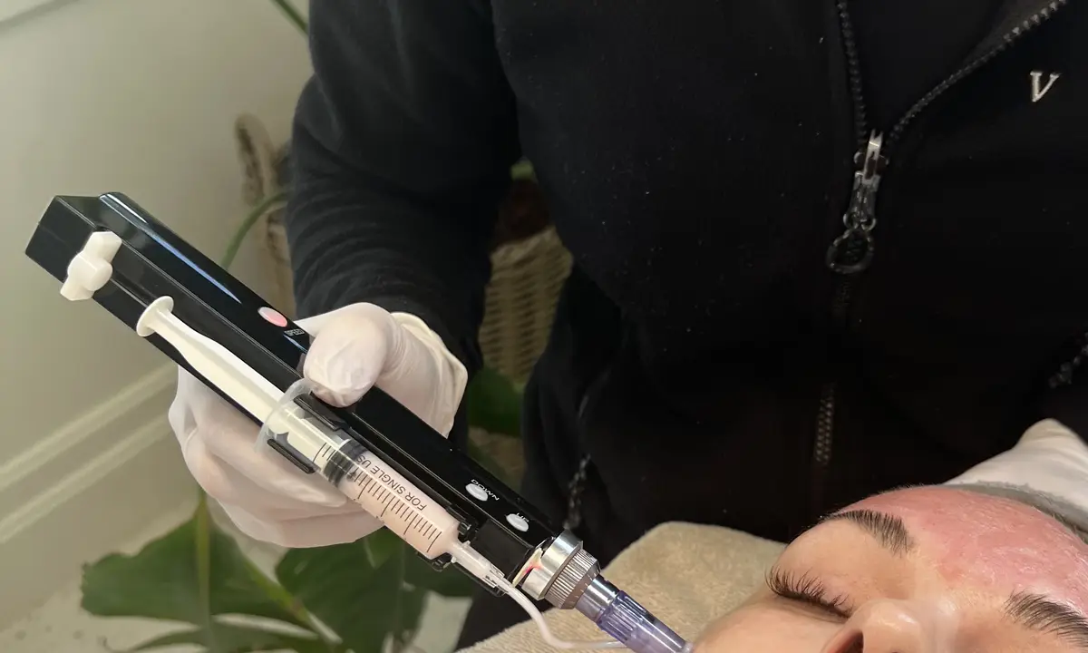Meso SkinPen microneedling mod panden hos VIDA Skønhedsklinik